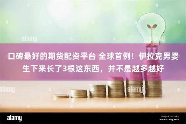 口碑最好的期货配资平台 全球首例！伊拉克男婴生下来长了3根这东西，并不是越多越好